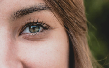 7 mitos sobre la Toxina Botulínica (botox) para las patas de gallo
