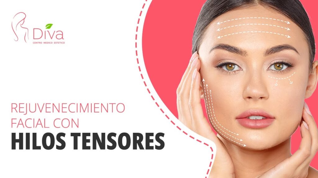 hilos tensores