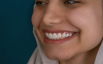 5 beneficios de usar ácido hialurónico para los surcos nasogenianos