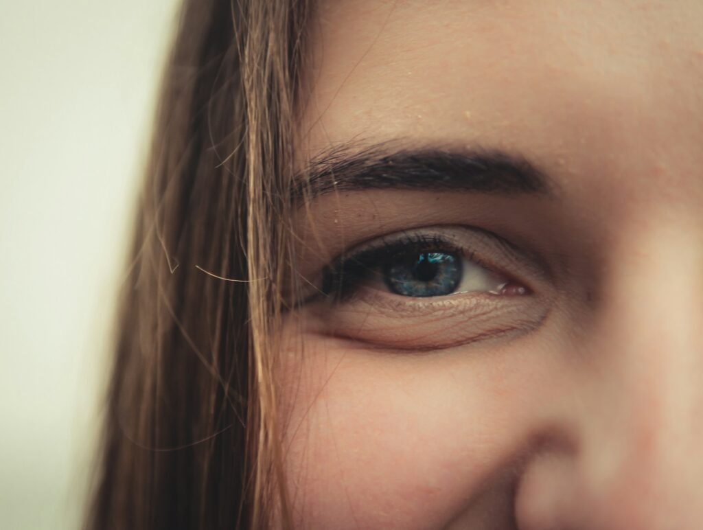 Tratamiento de ojeras con ácido hialurónico ¿Por qué elegir a Diva Centro Médico Estético Los Olivos?